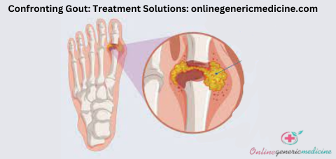 Gout Medication Gout Medication