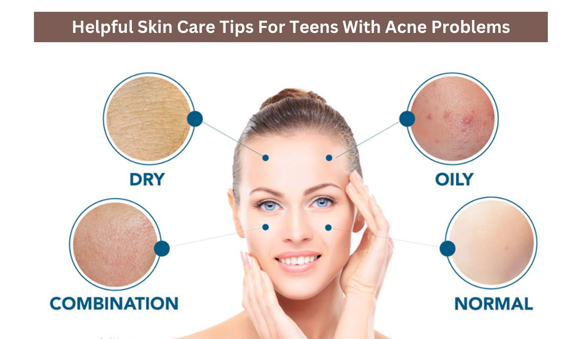 Helpful Skin Care Tips For Teens With Acne Problems