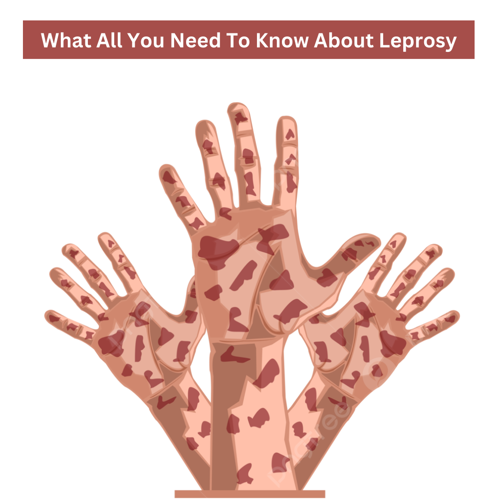 Understanding Leprosy in 2025: Causes, Symptoms, Treatment & Affordable Solutions